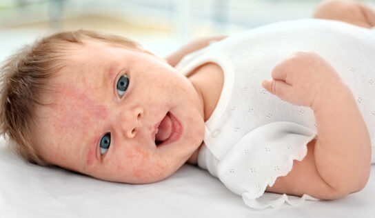 Ausschlag beim Baby – was steckt dahinter?
