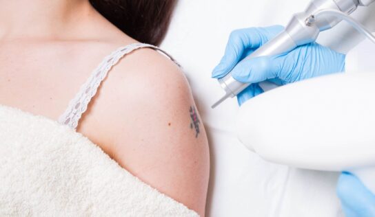 Tattooentfernung durch PicoSure & Co.