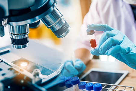 lab technician assistant analyzing a blood sample in test tube a