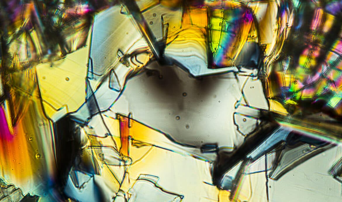 Was ist Phenylalanin?